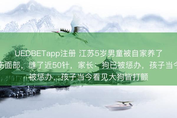 UEDBETapp注册 江苏5岁男童被自家养了几年的哈士奇咬伤面部，缝了近50针，家长：狗已被惩办，孩子当今看见大狗皆打颤